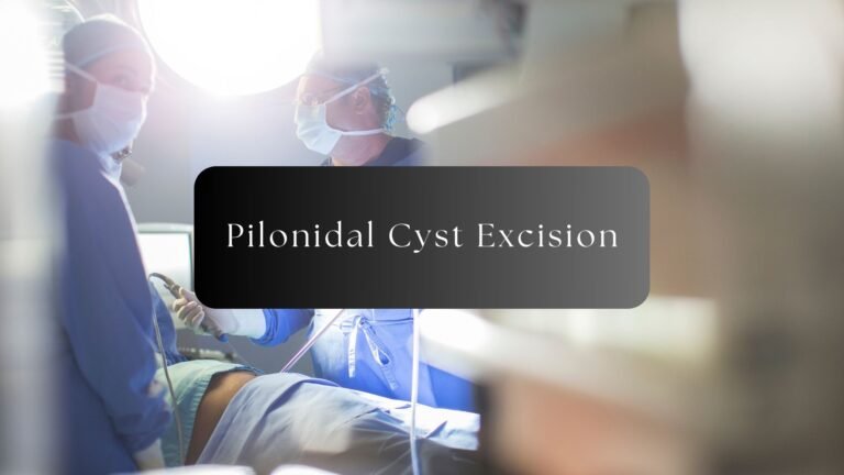 pilonidal cyst excision